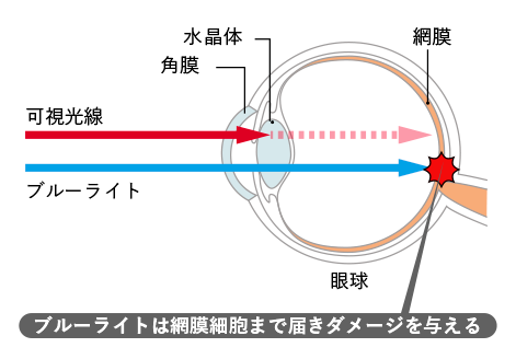 ブルーライトは網膜細胞まで届きダメージを与える